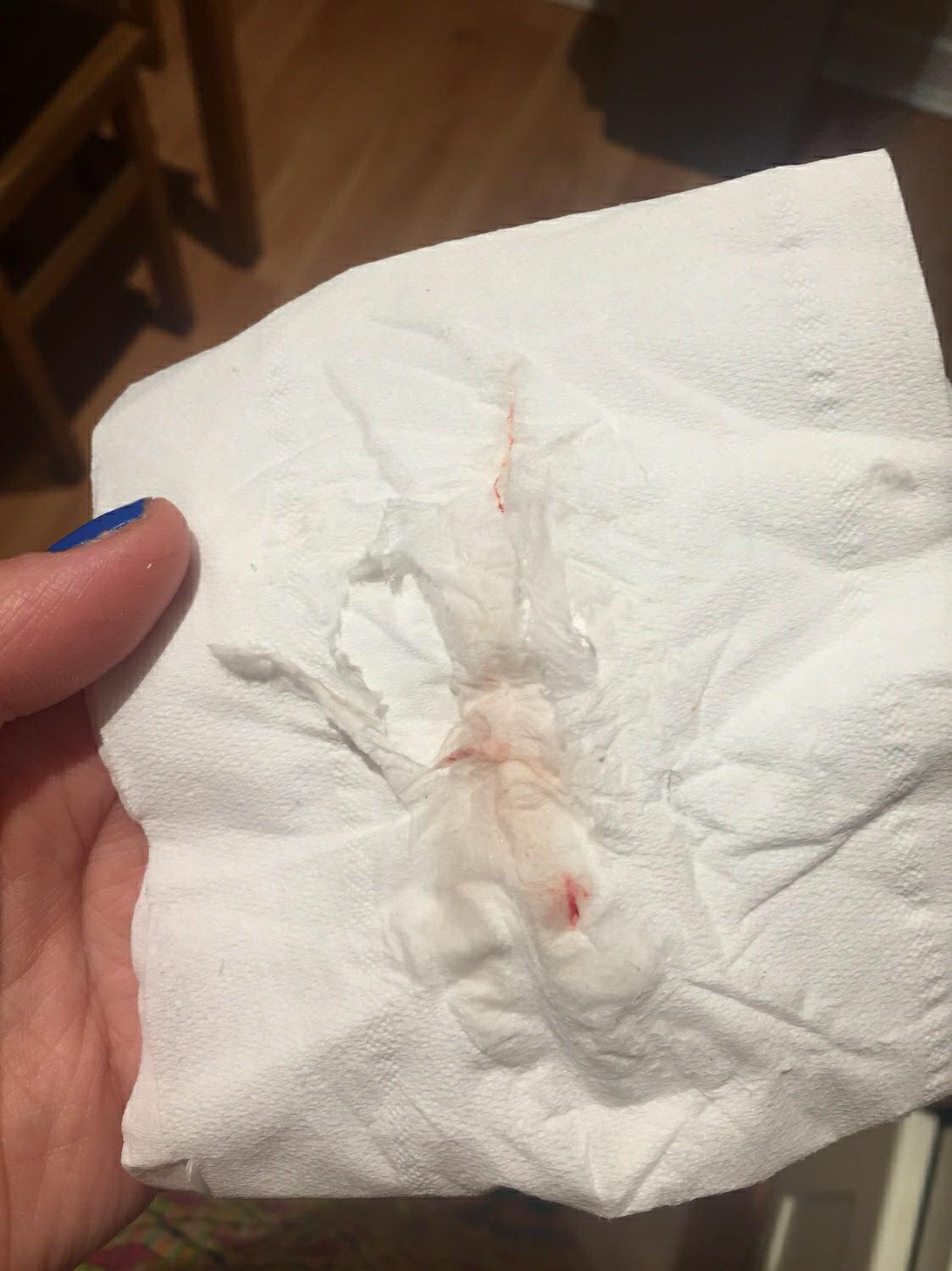 implantation bleeding