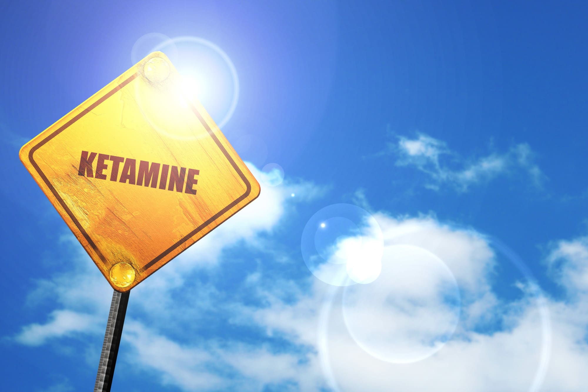 Ketamine and Anxiety: A Guide to How it Works and What You Need to Know