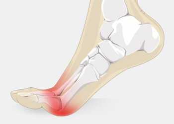 pain in ball of foot