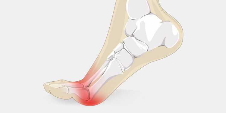 pain in ball of foot