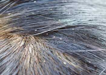 what do lice look like