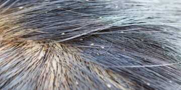 what do lice look like
