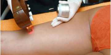 Ways Laser Therapy Healthy