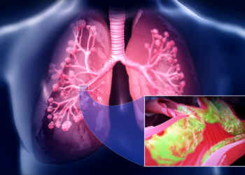 latest lung cancer screening guidelines