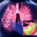 latest lung cancer screening guidelines