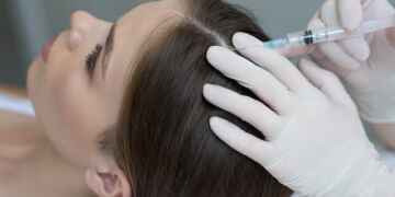 Treatments for Hair Loss
