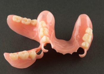 Advantages of Partial Dentures