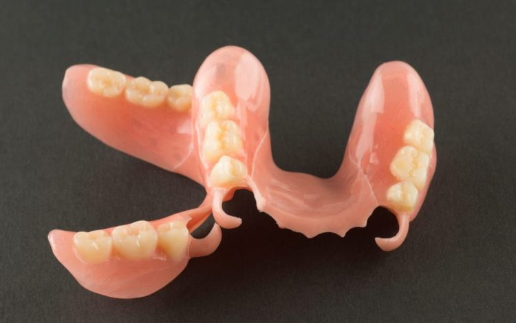 Advantages of Partial Dentures
