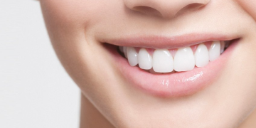 Implants and Invisalign: Enhancing Your Smile Transformation